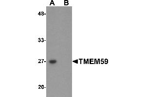 Western Blotting (WB) image for anti-Transmembrane Protein 59 (TMEM59) (N-Term) antibody (ABIN1031631) (TMEM59 anticorps  (N-Term))