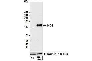Western Blotting (WB) image for anti-Nitric Oxide Synthase 2, Inducible (NOS2) (AA 1103-1153) antibody (ABIN7452587)