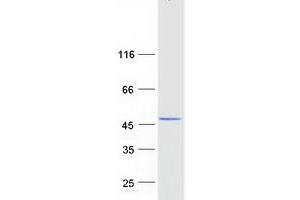 Validation with Western Blot