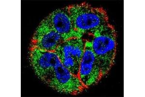 Confocal immunofluorescent analysis of p53 antibody with A2058 cells followed by Alexa Fluor 488-conjugated goat anti-rabbit lgG (green).