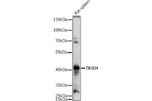 Western blot analysis of extracts of Rat spleen, using TIMD4 antibody (ABIN7270705) at 1:1000 dilution. (TIMD4 anticorps  (AA 25-130))