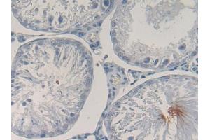 DAB staining on IHC-P; Samples: Rat Testis Tissue (POMC anticorps  (AA 27-235))