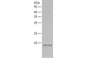 Western Blotting (WB) image for Dynein, Light Chain, Roadblock Type 1 (DYNLRB1) (AA 1-96) protein (His-IF2DI Tag) (ABIN7122722)