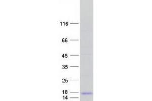Validation with Western Blot