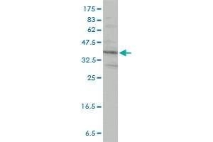 PRKRA monoclonal antibody (M01), clone 1B9-1A7 Western Blot analysis of PRKRA expression in HeLa .