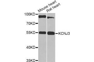 Western blot analysis of extracts of various cell lines, using KCNJ3 Antibody (ABIN6003556) at 1/1000 dilution. (KCNJ3 anticorps)