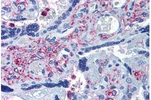 Immunohistochemical staining of human placenta with ADAMTS5 polyclonal antibody . (ADAMTS5 anticorps  (Internal Region))