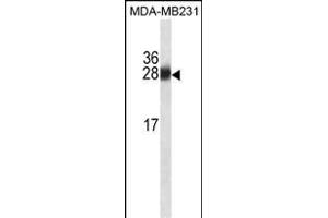 GSTM1 Antibody ABIN1539938 western blot analysis in MDA-M cell line lysates (35 μg/lane). (GSTM1 anticorps  (AA 184-211))