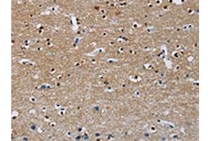 The image on the left is immunohistochemistry of paraffin-embedded Human brain tissue using ABIN7130272(MSH5 Antibody) at dilution 1/30, on the right is treated with fusion protein. (MSH5 anticorps)
