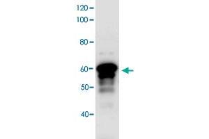 Western blot analysis bacterial lysate of MBP-fused antigen protein by using Myt1l polyclonal antibody (Cat. (MYT1L anticorps)