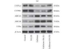 Lithogenic diet induced disorders of cholesterol synthesis and transport in liver.