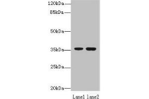Western blot All lanes: EEF2KMT antibody at 6 μg/mL Lane 1: Hela whole cell lysate Lane 2: 293T whole cell lysate Secondary Goat polyclonal to rabbit IgG at 1/10000 dilution Predicted band size: 37, 34 kDa Observed band size: 37 kDa (EEF2KMT (AA 1-330) anticorps)