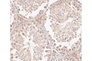 Immunohistochemistry of paraffin-embedded Mouse testis using VEGF Receptor 2 Polyclonal Antibody at dilution of 1:100 (40x lens). (VEGFR2/CD309 anticorps)