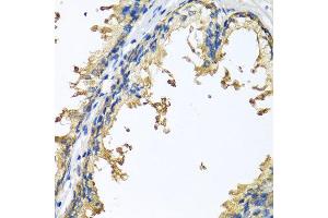 Immunohistochemistry of paraffin-embedded human prostate using NLGN4Y antibody at dilution of 1:100 (x40 lens). (Neuroligin Y anticorps)