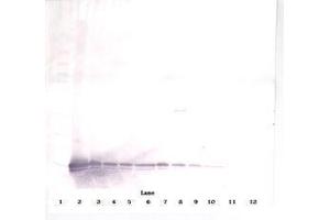 Image no. 2 for anti-gamma-Interferon-Induced Monokine (CXCL9) antibody (ABIN465878) (CXCL9 anticorps)