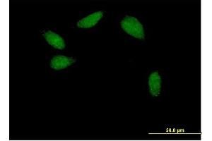 Immunofluorescence of purified MaxPab antibody to TCF2 on HeLa cell. (HNF1B anticorps  (AA 1-557))