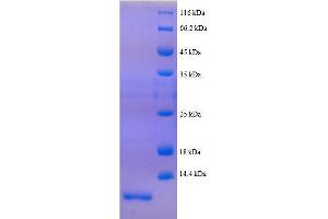 Peptide YY (AA 31-64), (full length) protein (His tag)