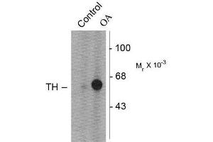 Image no. 1 for anti-Tyrosine Hydroxylase (TH) (pSer31) antibody (ABIN372737) (Tyrosine Hydroxylase anticorps  (pSer31))