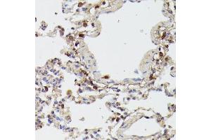 Immunohistochemistry of paraffin-embedded rat lung using RIPK1/RIP antibody (ABIN6132596, ABIN6146959, ABIN6146960 and ABIN6223282) at dilution of 1:100 (40x lens).