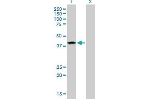 Western Blot analysis of ELAC1 expression in transfected 293T cell line by ELAC1 MaxPab polyclonal antibody. (ELAC1 anticorps  (AA 1-363))