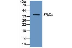 Detection of Recombinant HIF2a, Mouse using Polyclonal Antibody to Hypoxia Inducible Factor 2 Alpha (HIF2a)