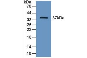 Detection of Recombinant HIF2a, Mouse using Polyclonal Antibody to Hypoxia Inducible Factor 2 Alpha (HIF2a) (EPAS1 anticorps  (AA 21-336))