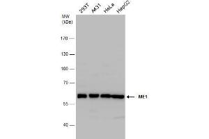 WB Image ME1 antibody detects ME1 protein by western blot analysis. (ME1 anticorps)
