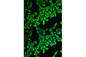 Immunofluorescence (IF) image for anti-Death-Associated Protein (DAP) antibody (ABIN1877136) (DAP anticorps)