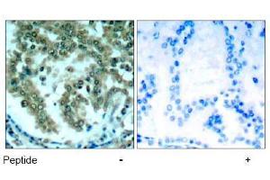 Image no. 1 for anti-Protein Kinase C, theta (PRKCQ) (AA 674-678) antibody (ABIN197566) (PKC theta anticorps  (AA 674-678))