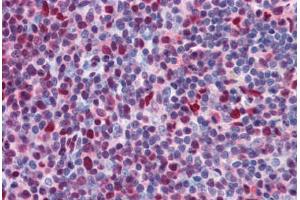 Human Tonsil: Formalin-Fixed, Paraffin-Embedded (FFPE)