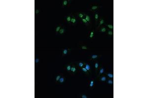 Immunofluorescence analysis of U-2 OS cells using TDP-43/TARDB Polyclonal Antibody (ABIN7270731) at dilution of 1:100 (40x lens). (TARDBP anticorps  (AA 1-260))