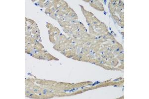 Immunohistochemistry of paraffin-embedded mouse heart using SMYD1 antibody (ABIN6128707, ABIN6148163, ABIN6148165 and ABIN6219496) at dilution of 1:200 (40x lens). (SMYD1 anticorps  (AA 1-350))