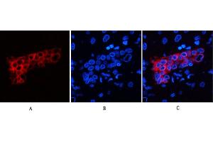 Immunofluorescence analysis of human liver tissue. (Cytokeratin 7 anticorps)