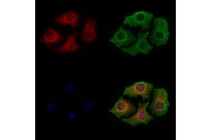 ABIN6259700 and ABIN6279057 staining Hela cells by IF/ICC.