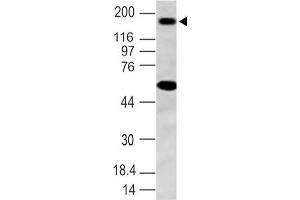 Image no. 1 for anti-NLR Family, Pyrin Domain Containing 3 (NLRP3) (AA 150-385) antibody (ABIN5027384) (NLRP3 anticorps  (AA 150-385))