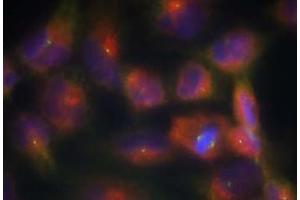Image no. 1 for anti-Microtubule-Associated Protein tau (MAPT) (Ser356) antibody (ABIN401616) (MAPT anticorps  (Ser356))