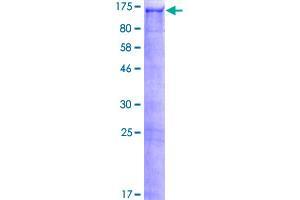 Image no. 1 for PDZ Domain Containing Ring Finger 3 (PDZRN3) (AA 1-1066) protein (GST tag) (ABIN1314620)