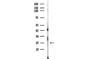 anti-RAB2B, Member RAS Oncogene Family (RAB2B) (Internal Region) antibody