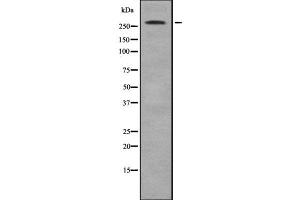 Western blot analysis of ACACB using MCF7 whole  lysates. (Acetyl-CoA Carboxylase beta anticorps  (N-Term))