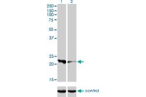 Western blot analysis of CAPS over-expressed 293 cell line, cotransfected with CAPS Validated Chimera RNAi (Lane 2) or non-transfected control (Lane 1). (Calcyphosine anticorps  (AA 1-109))