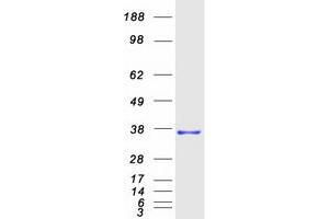 Validation with Western Blot
