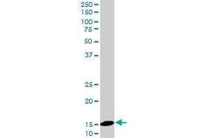 UBE2D2 monoclonal antibody (M02), clone 4A1.
