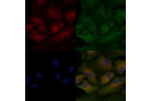 ABIN6259968 and ABIN6266497 staining  cells by IF/ICC. (APAF1 anticorps  (C-Term))