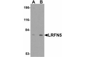 Image no. 1 for anti-Leucine Rich Repeat and Fibronectin Type III Domain Containing 5 (LRFN5) (C-Term) antibody (ABIN478054) (LRFN5 anticorps  (C-Term))