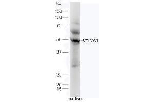 Mouse liver lysates probed with Anti-CYP7A1 Polyclonal Antibody, Unconjugated (ABIN739725) at 1:300 in 4˚C. (CYP7A1 anticorps  (AA 351-400))