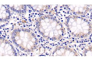 Detection of ERK1 in Human Colon Tissue using Monoclonal Antibody to Extracellular Signal Regulated Kinase 1 (ERK1)