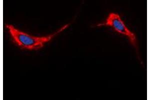 Immunofluorescent analysis of Aquaporin 2 staining in HeLa cells. (AQP2 anticorps  (C-Term))