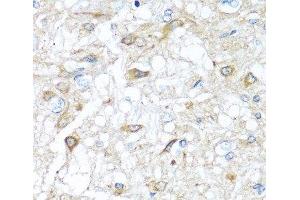Immunohistochemistry of paraffin-embedded Rat brain using RAC2 Polyclonal Antibody at dilution of 1:100 (40x lens).
