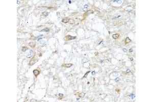 Immunohistochemistry of paraffin-embedded Rat brain using RAC2 Polyclonal Antibody at dilution of 1:100 (40x lens). (RAC2 anticorps)