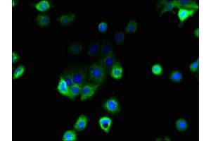 Immunofluorescent analysis of A431 cells using ABIN7158915 at dilution of 1:100 and Alexa Fluor 488-congugated AffiniPure Goat Anti-Rabbit IgG(H+L) (MFSD1 anticorps  (AA 1-38))